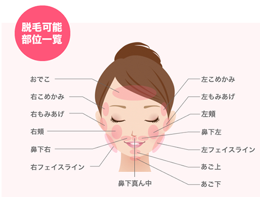 ストラッシュの顔脱毛-可能部位-画像